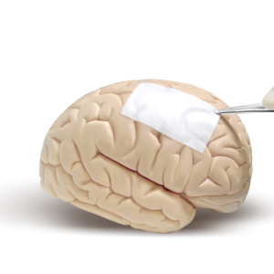 Regenerative Dural Repair Patch (Redura)