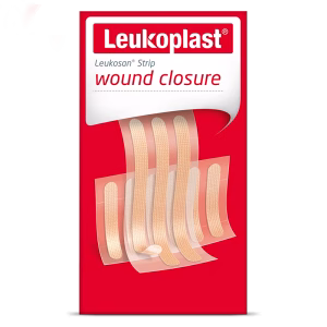 Wound closure strips
